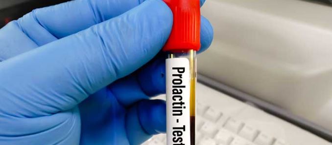 پرولاکتین چیست