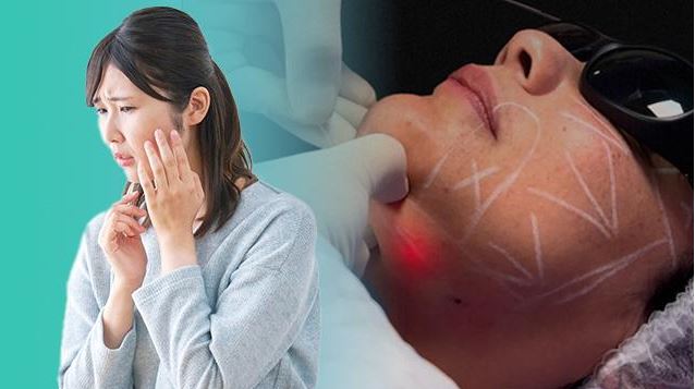اندولیفت دردناک است؟ راهنمای کامل و مراقبت‌های بعد از آن