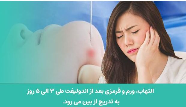 اندولیفت دردناک است؟ راهنمای کامل و مراقبتهای بعد از آن