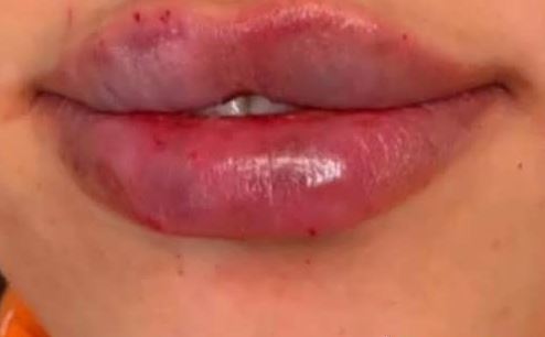 لب‌هایی صورتی و شاداب: با این روش‌ها به تیرگی لب پایان دهید