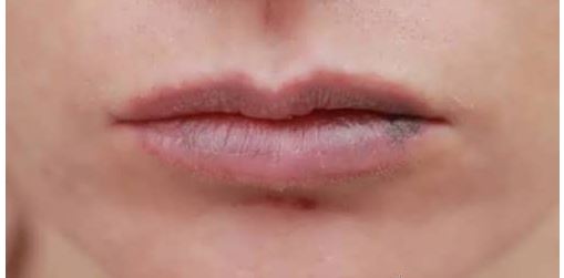 لب‌هایی صورتی و شاداب: با این روش‌ها به تیرگی لب پایان دهید