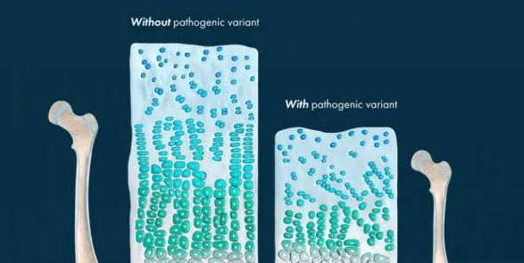 رشد استخوان چگونه انجام می‌شود؟ نگاهی علمی و ساده به شکل‌گیری اسکلت بدن