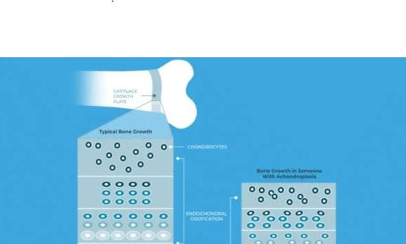 رشد استخوان چگونه انجام میشود؟ نگاهی علمی و ساده به شکلگیری اسکلت بدن