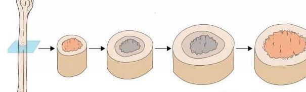 رشد استخوان چگونه انجام میشود؟ نگاهی علمی و ساده به شکلگیری اسکلت بدن